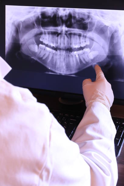 Best Emergency Tooth Extraction in St Marys, WV